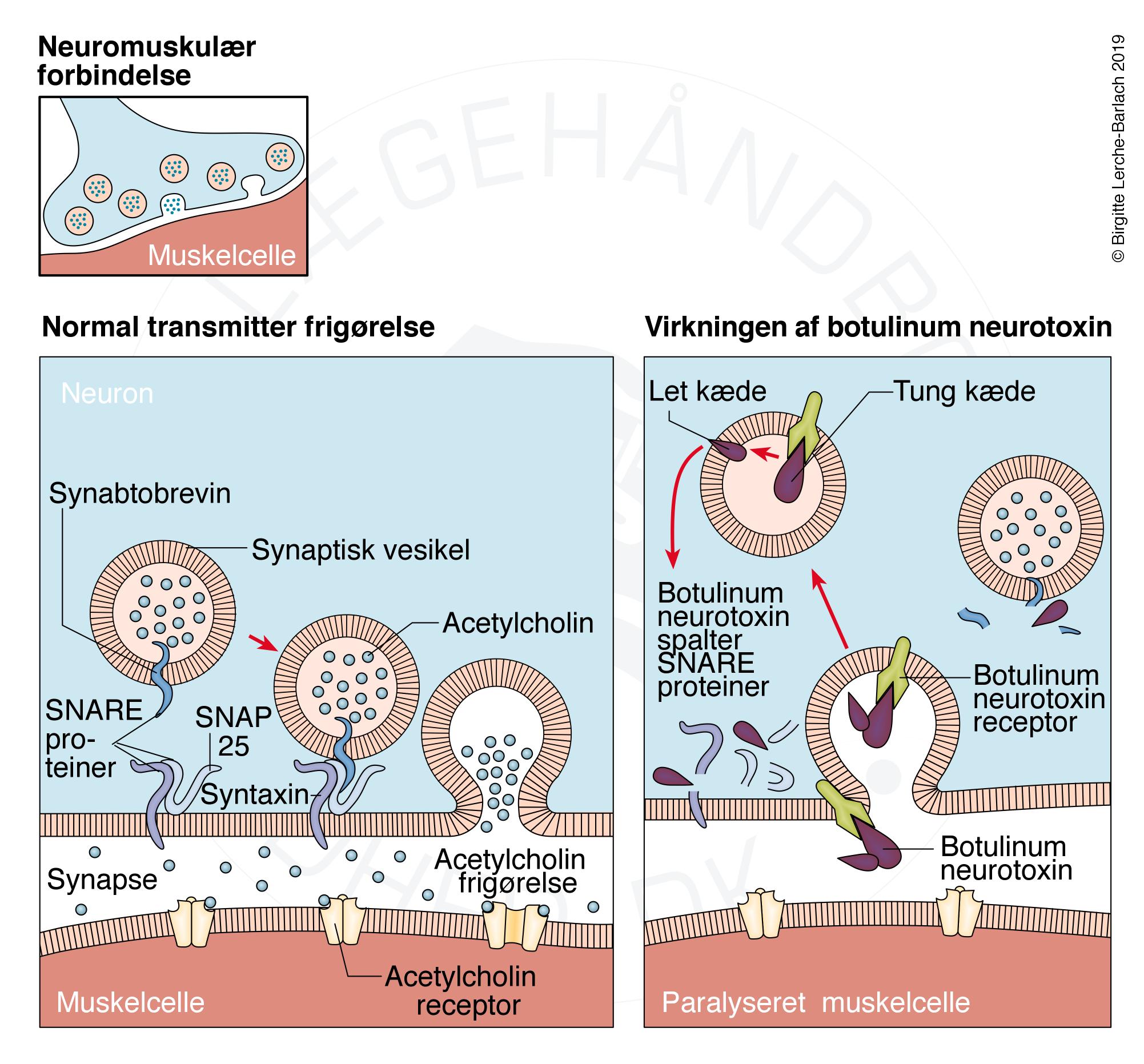 botox-graf-infektioner