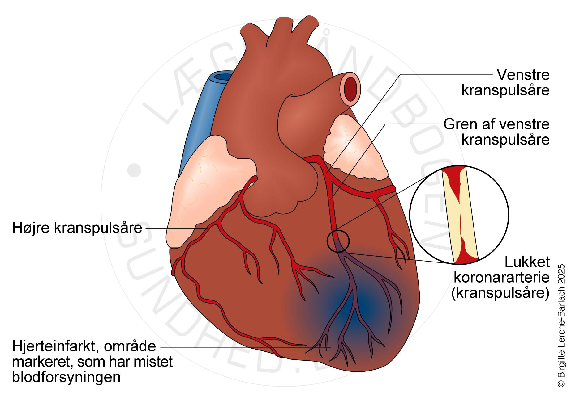 Hjerte med infakt_ny
