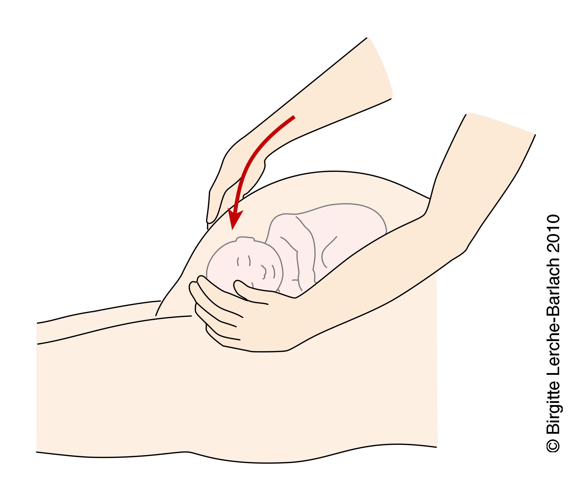 livmoder-ydre haandbreb