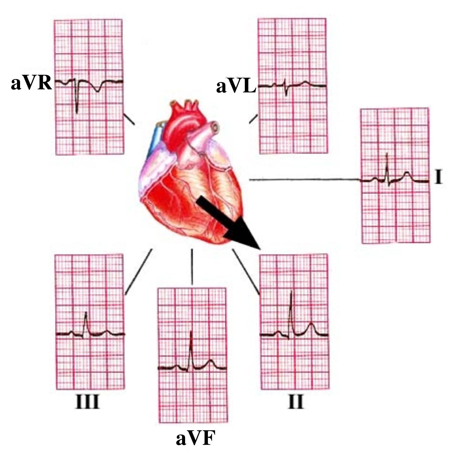hjerte-normal hjerteakse