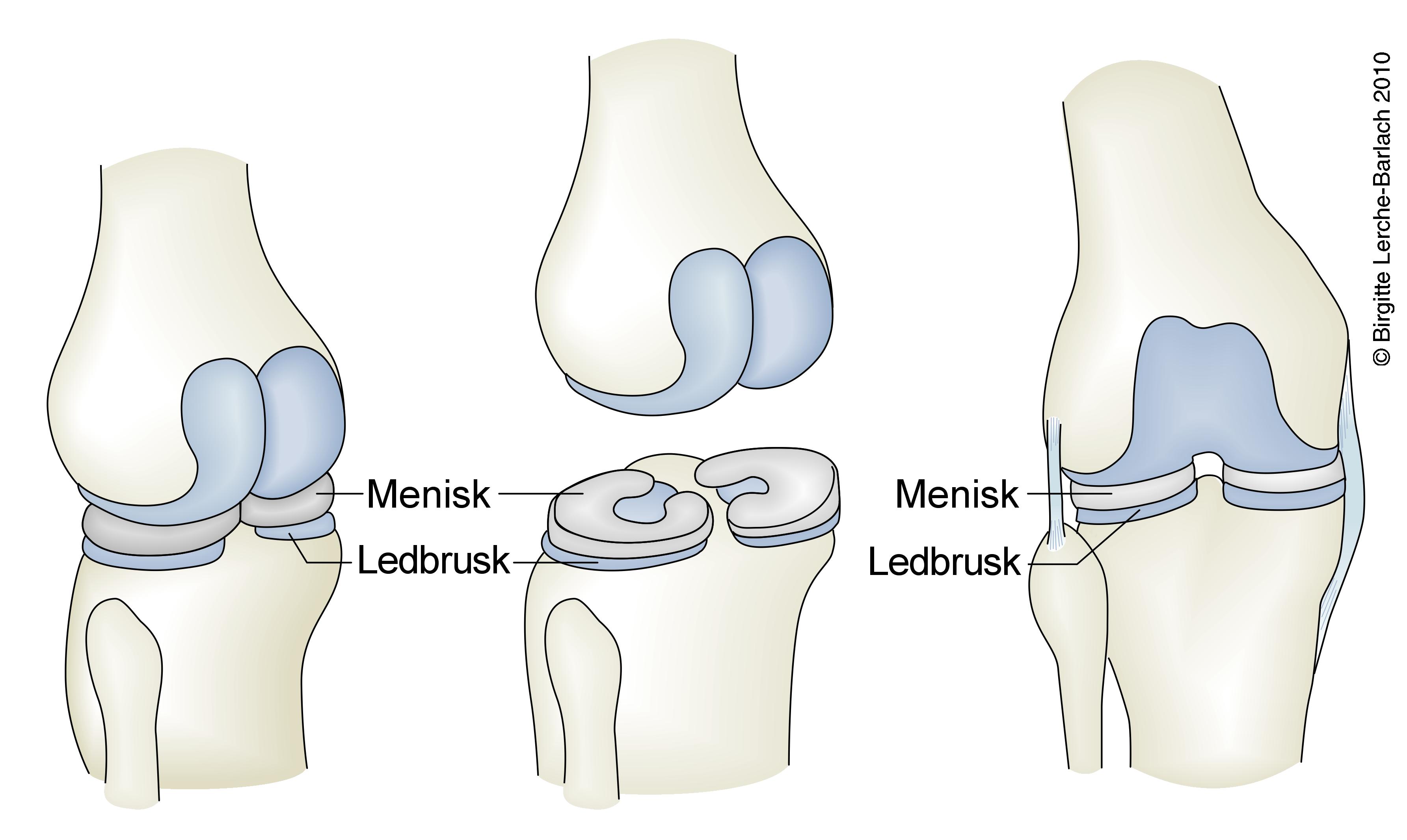 knae-menisker oversigt
