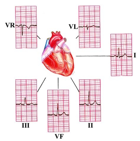 ekg i vertikalplanet