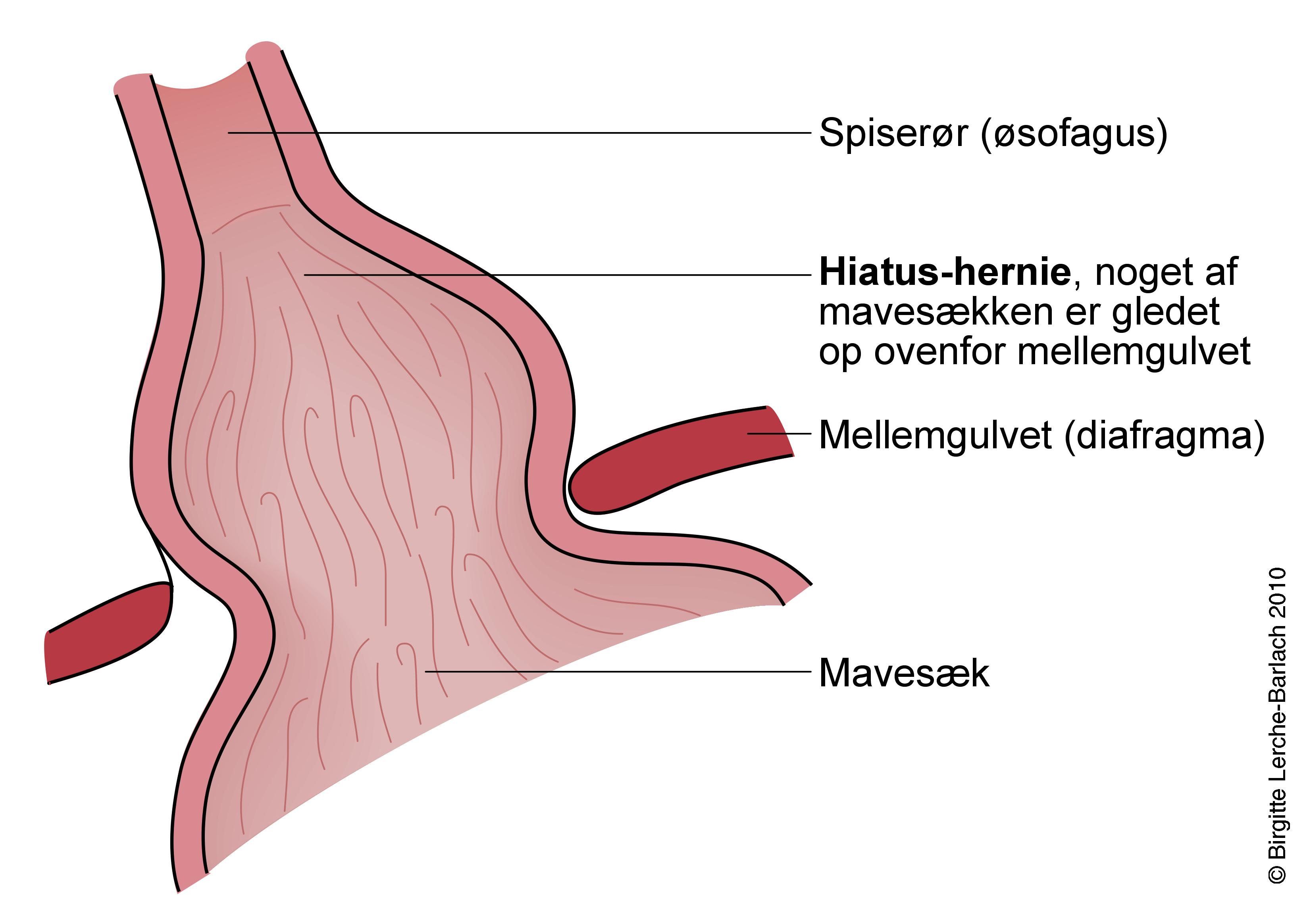 spiseroer-glidehernie