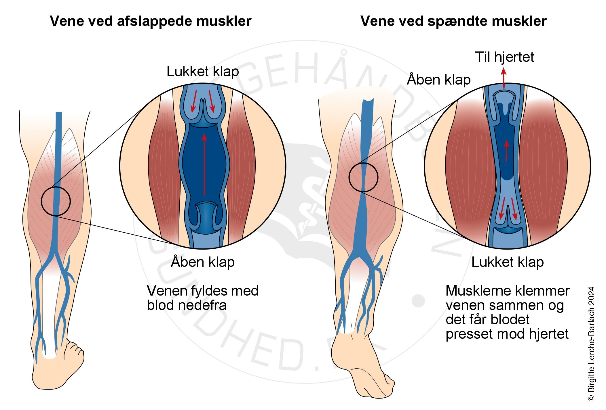LH_Vener og venepumper_Ny