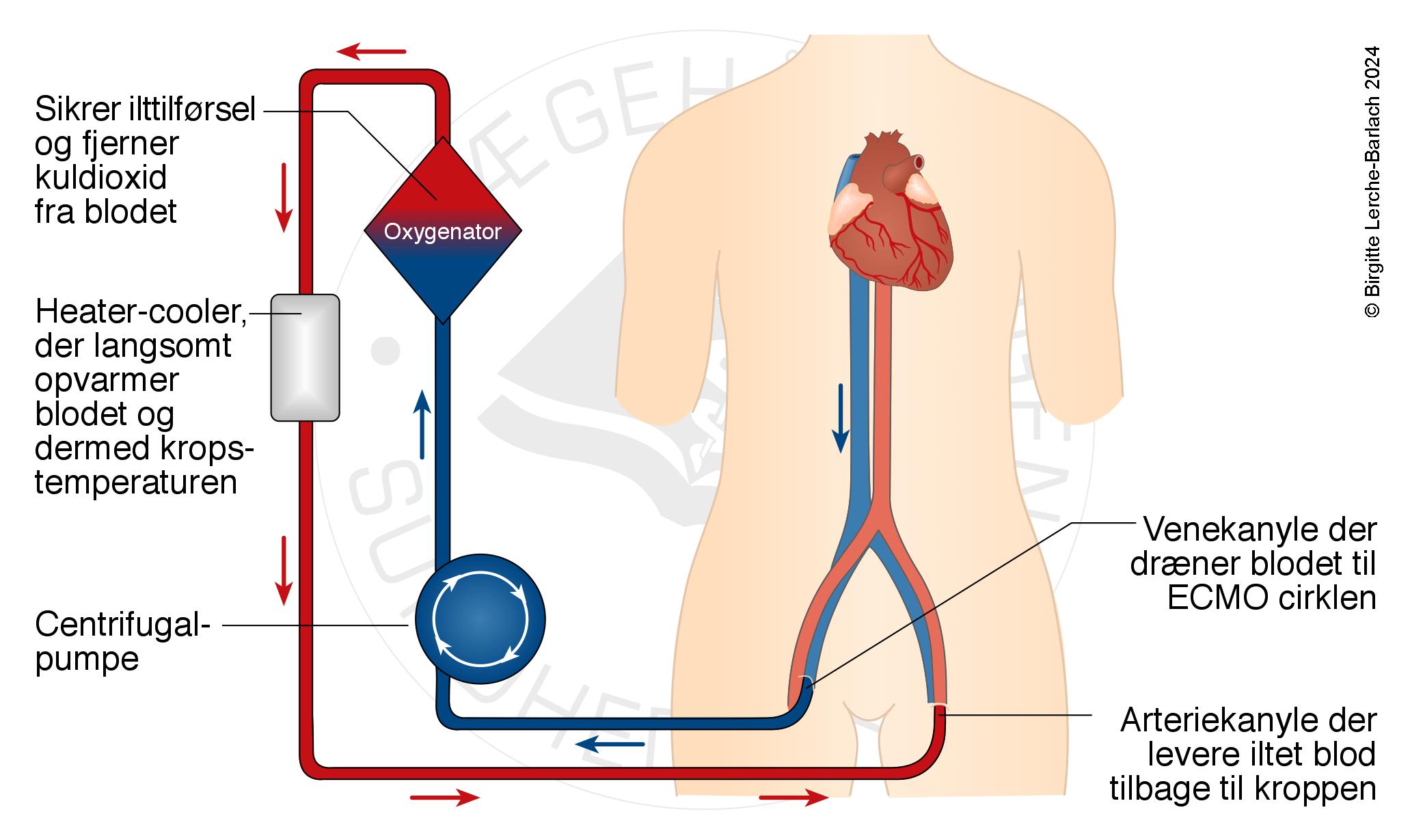 ekstrakorporal cirkulati
