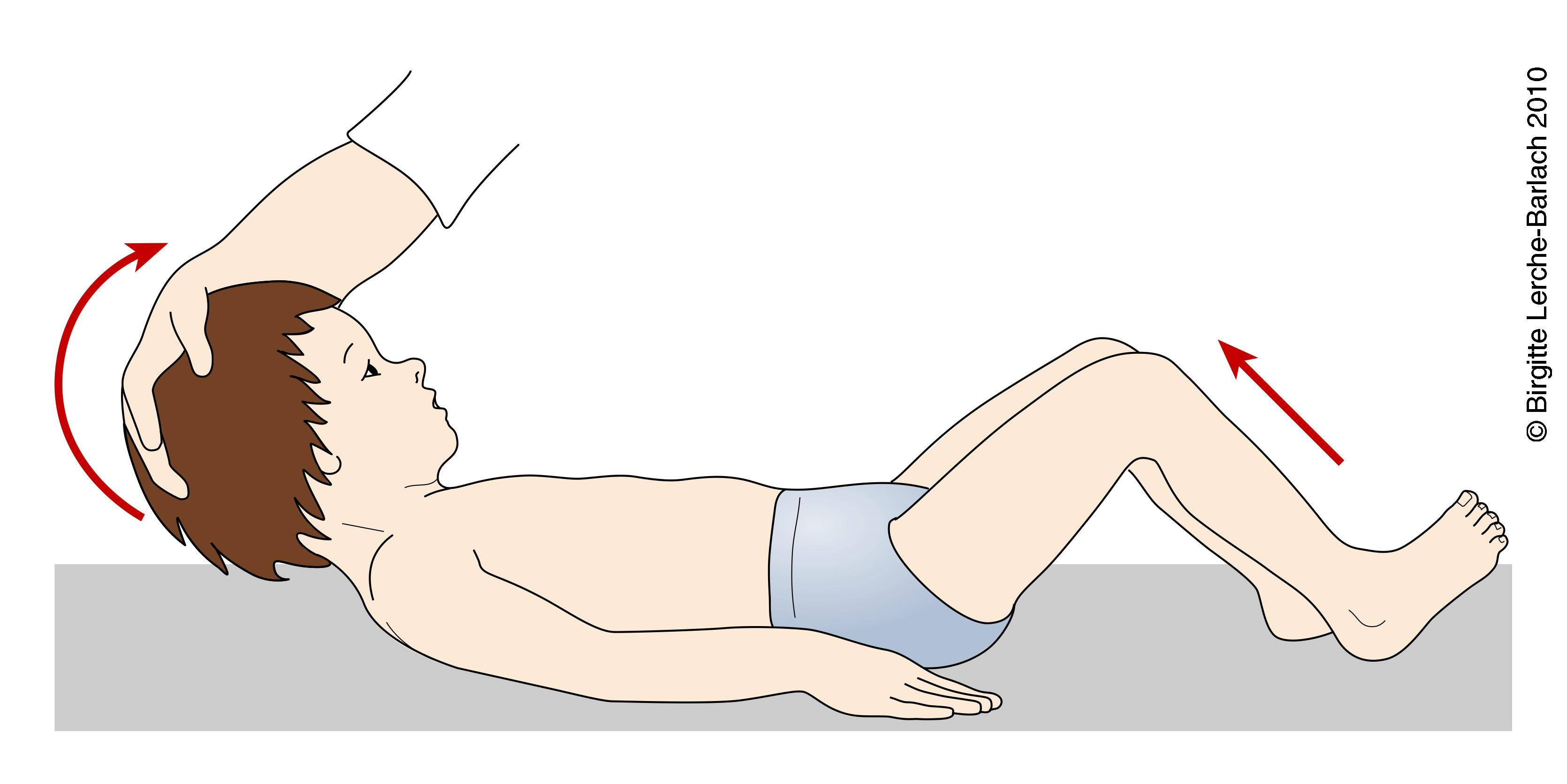 brudzinskystegn-menigitis jpg