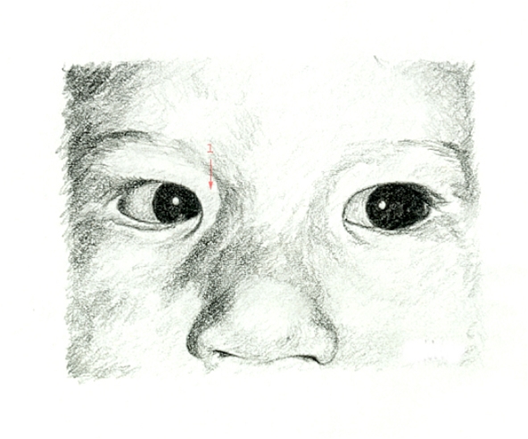 oejne-epicantusfold ved sideblik