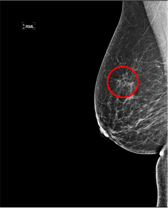 bryst-kraeft-ultralyd