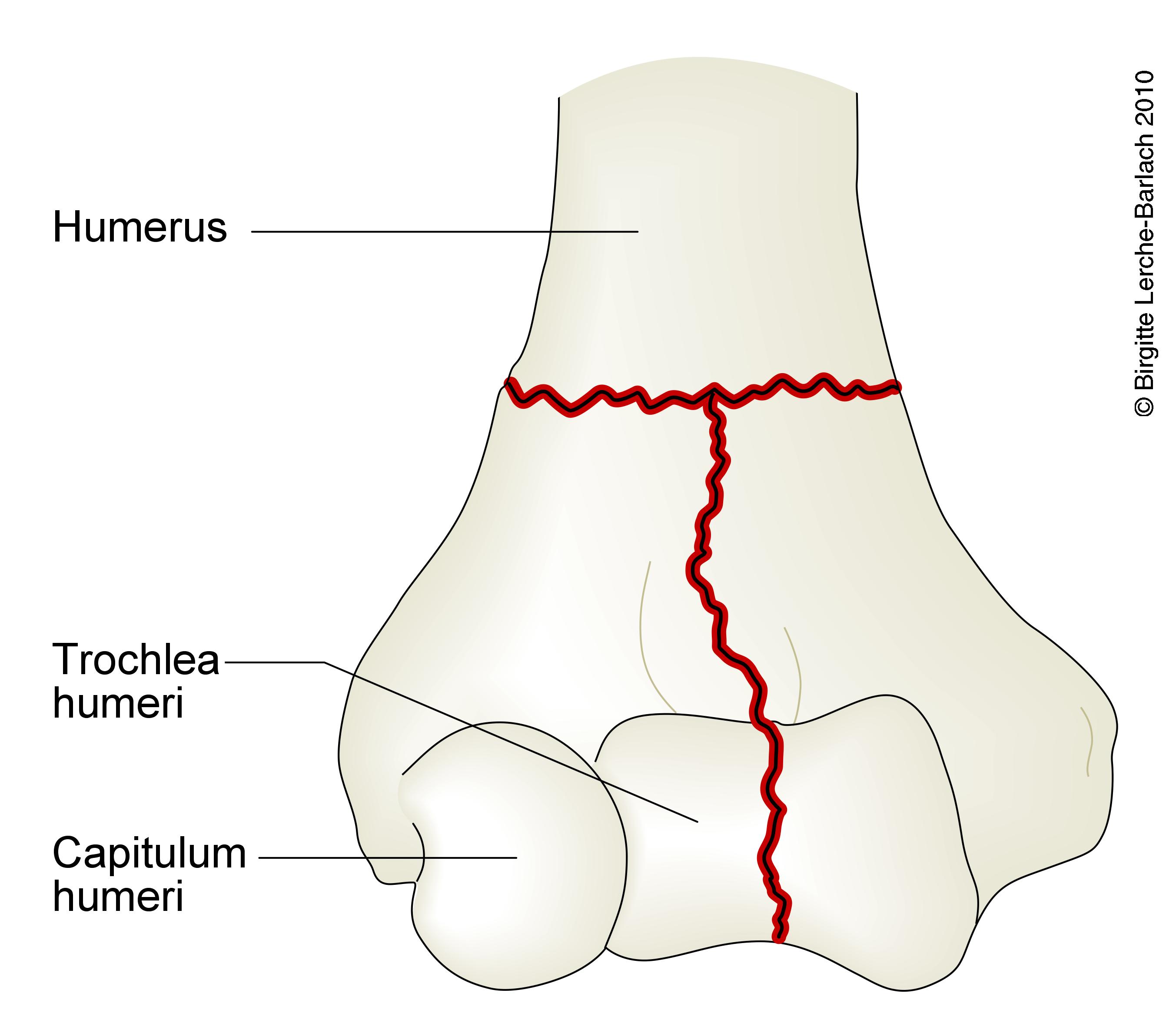 overarm-fraktur transkondylaer humerus 7323
