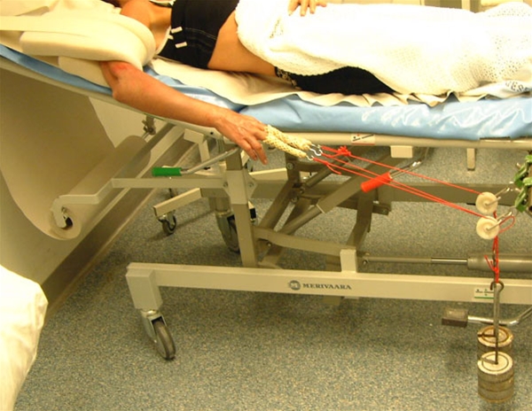 radius - fraktur - straek