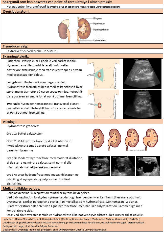 LH Actioncard hydronefrose