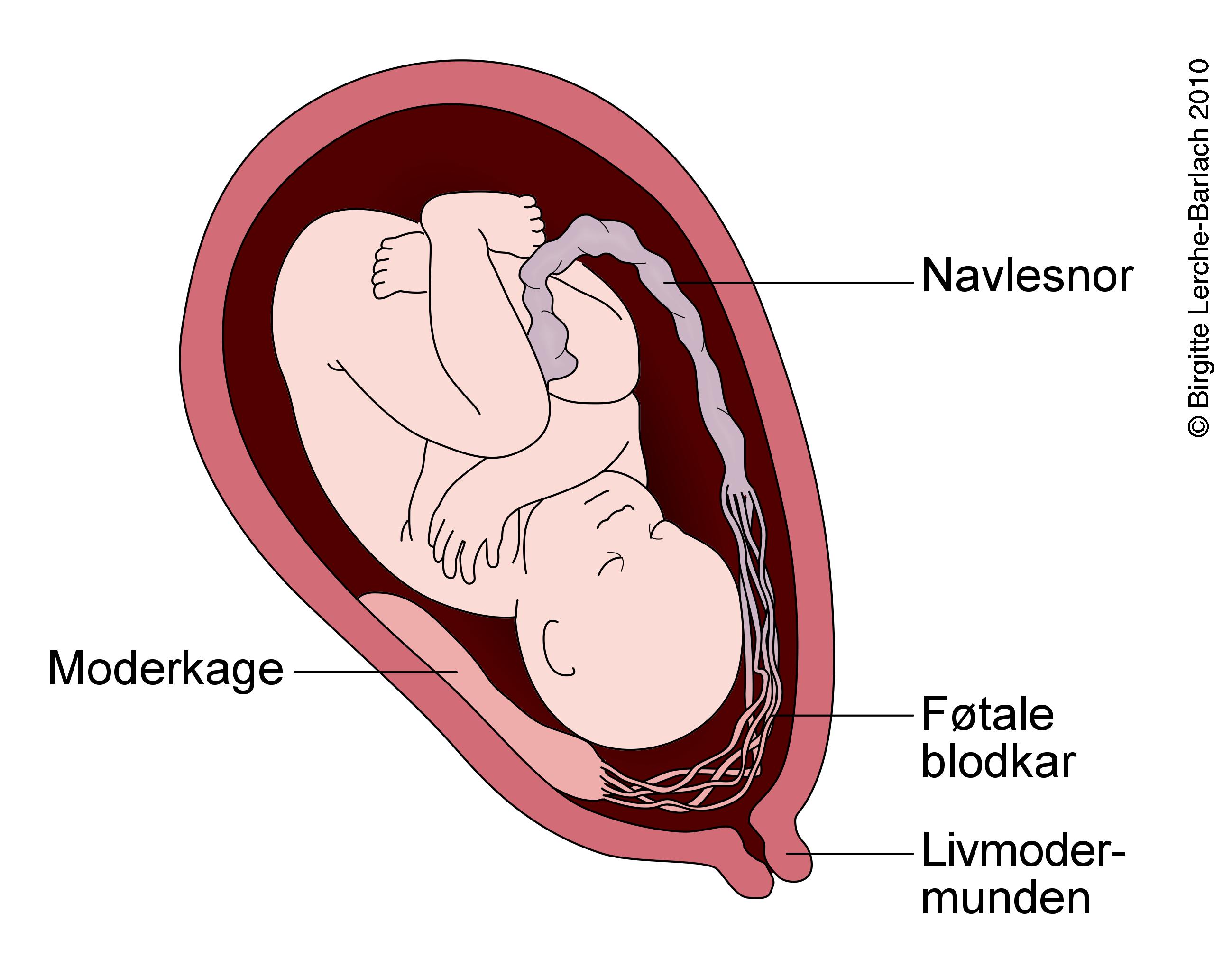 livmoder-vasa-praevia