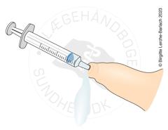Tegning der viser behandling af balanitis med engangssprøjte