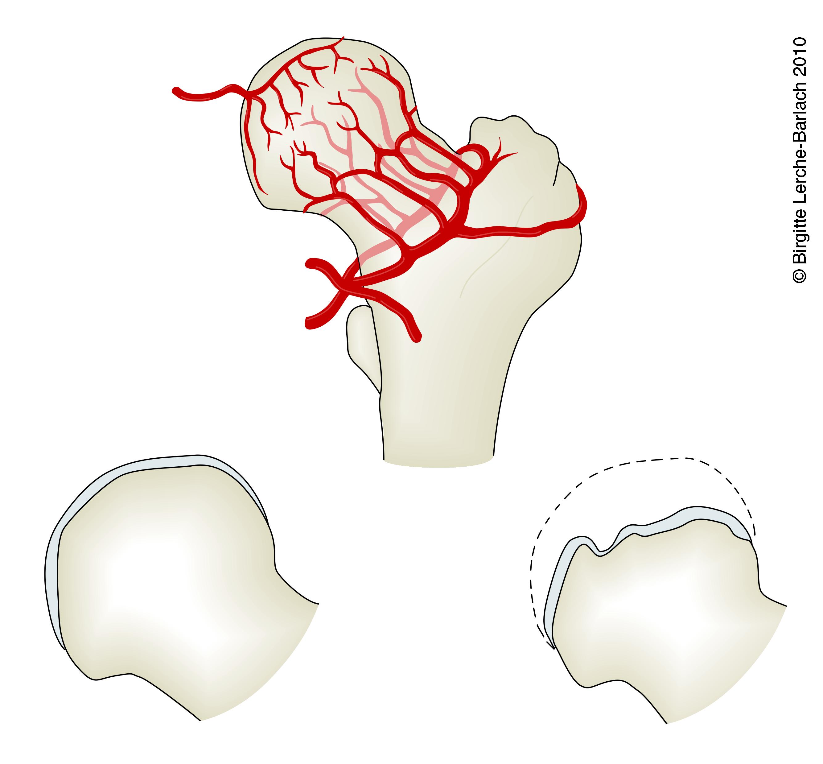 laarben-caput femoris blodforsyning