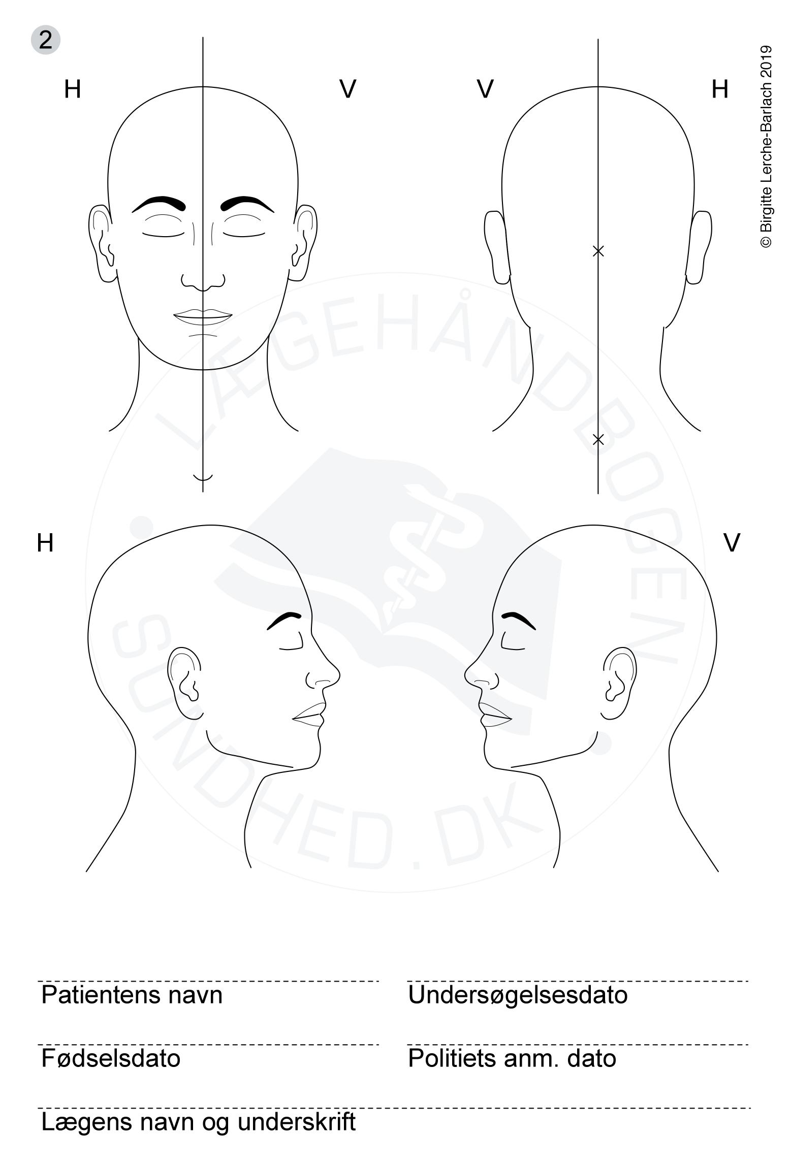 hoved-voldtaegt skitse