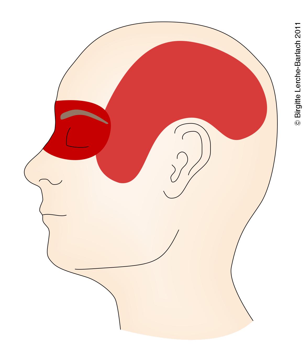 hoved-klyngehovedpine side