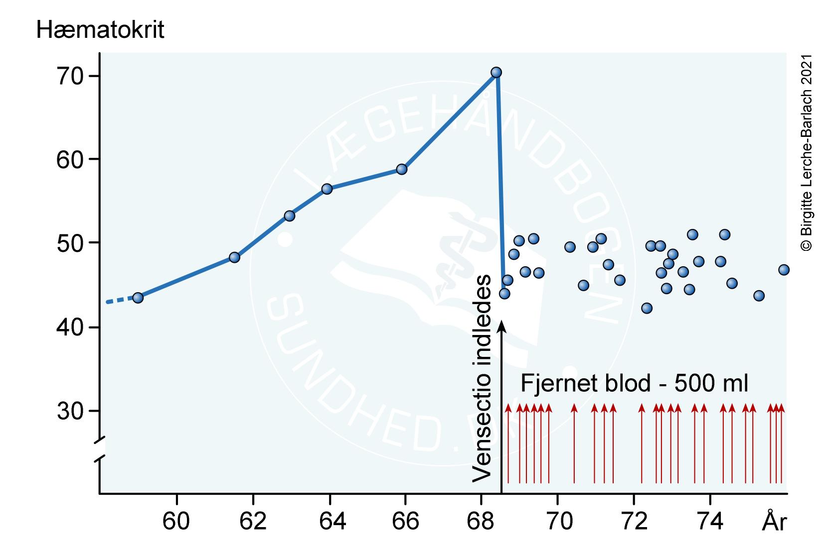 pv proliferative fase
