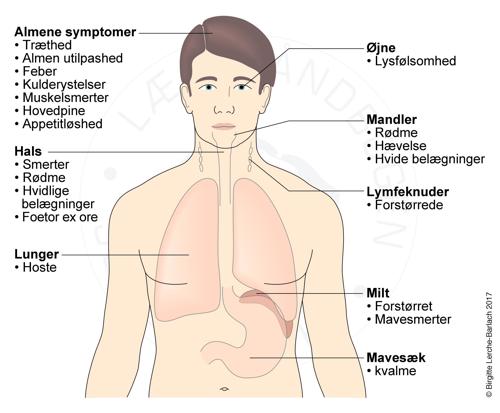 Symptomer ved meningitis.