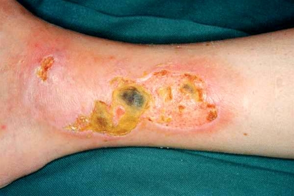 saar-venoest-saar toert-ben