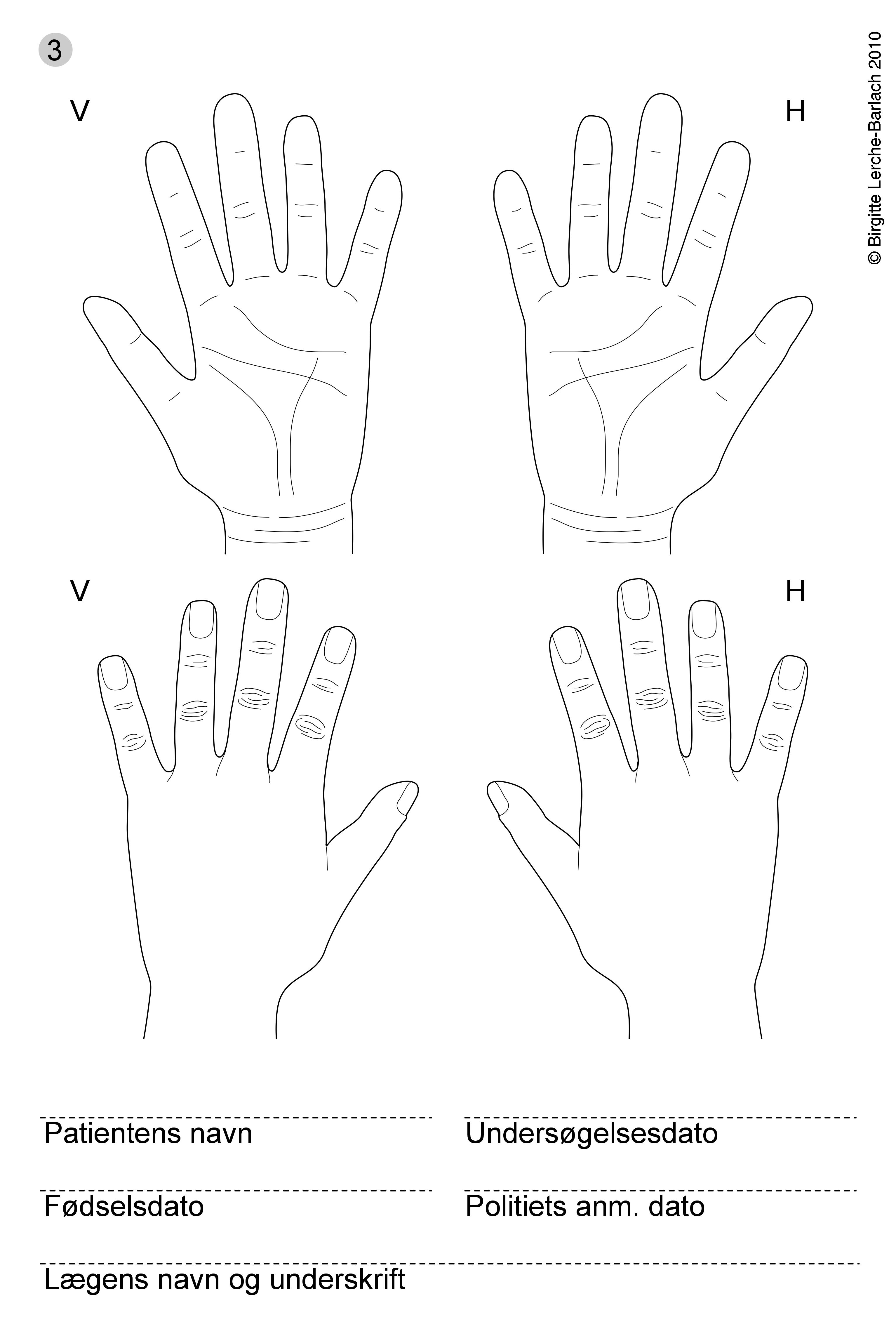 haender-voldtaegt skitse