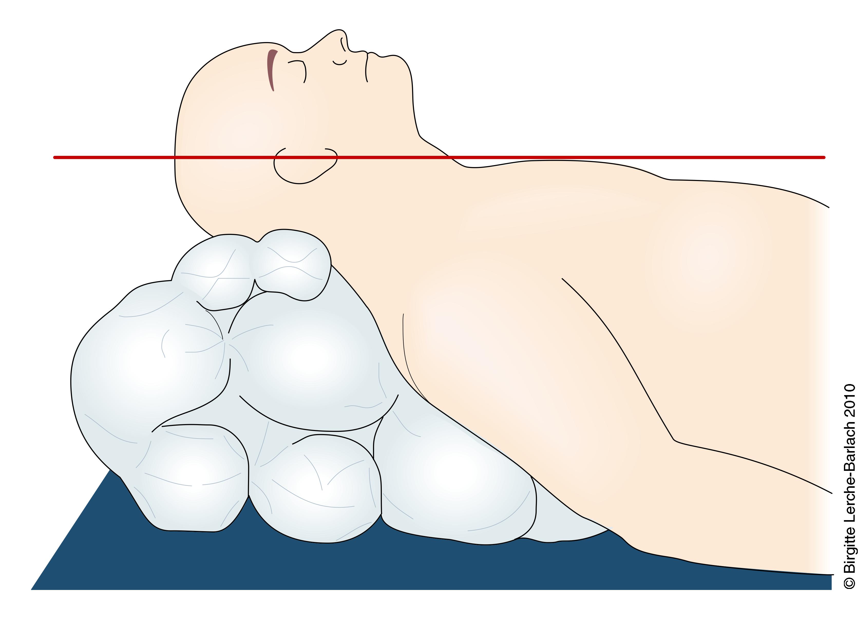 operation risikovurdering