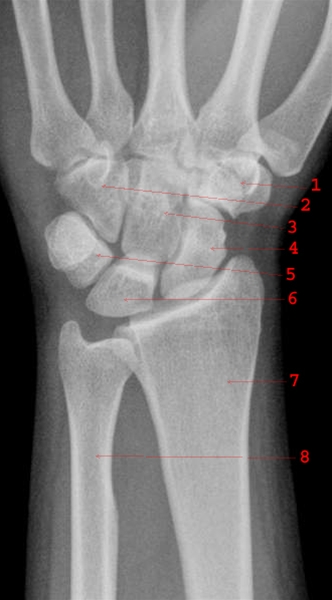 haand-knogler set forfra-roentgen-2