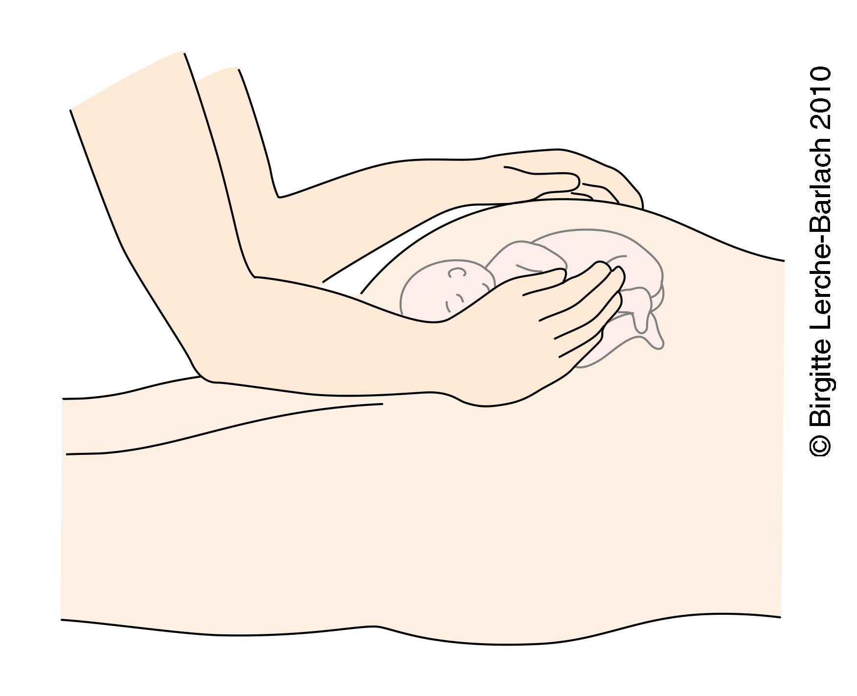 livmoder-ydre haandgreb