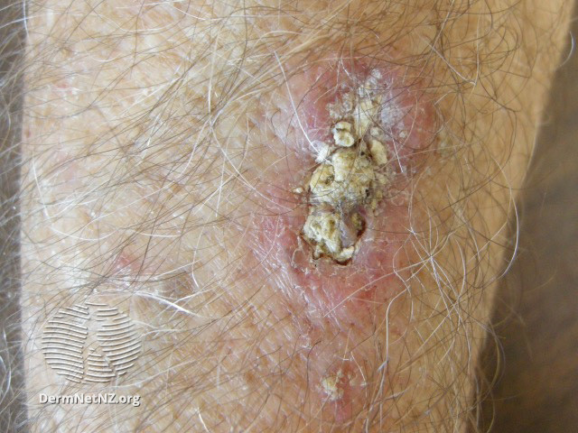 Pladecellekrft skinneben 50490