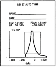 tympanogram-tynd arret trommehinde