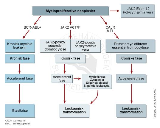 blod-klassifikation af de kroniske myeloproliferative sygdomme