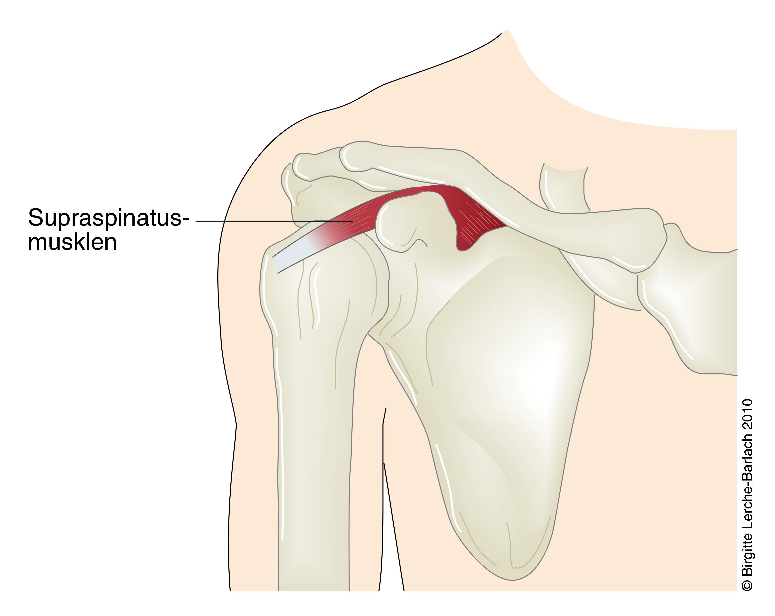 skulder-musculus-supraspinatus