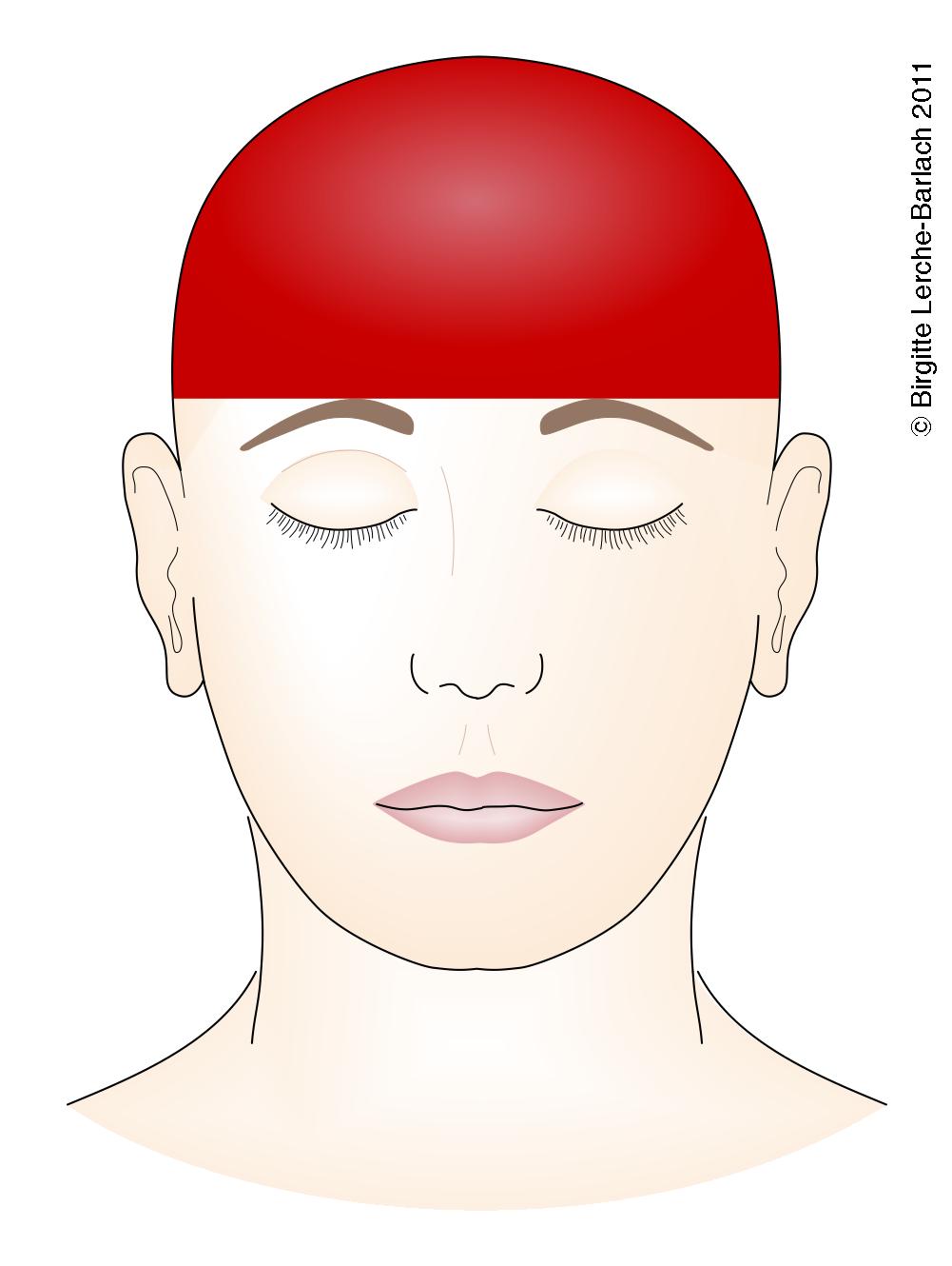 hoved-hovedpine udloest af medicinoverforbrug