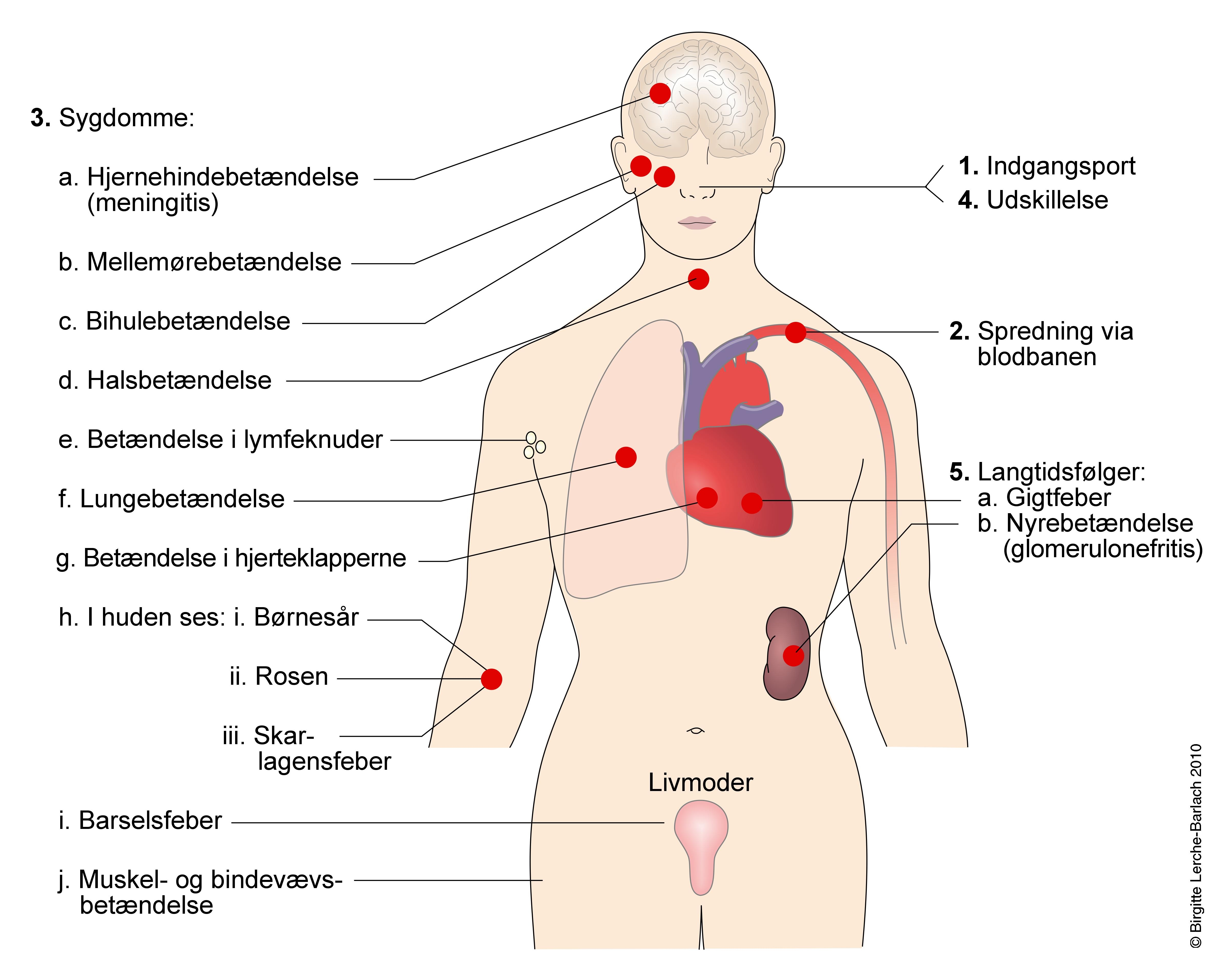 sygdomme ved streptokok