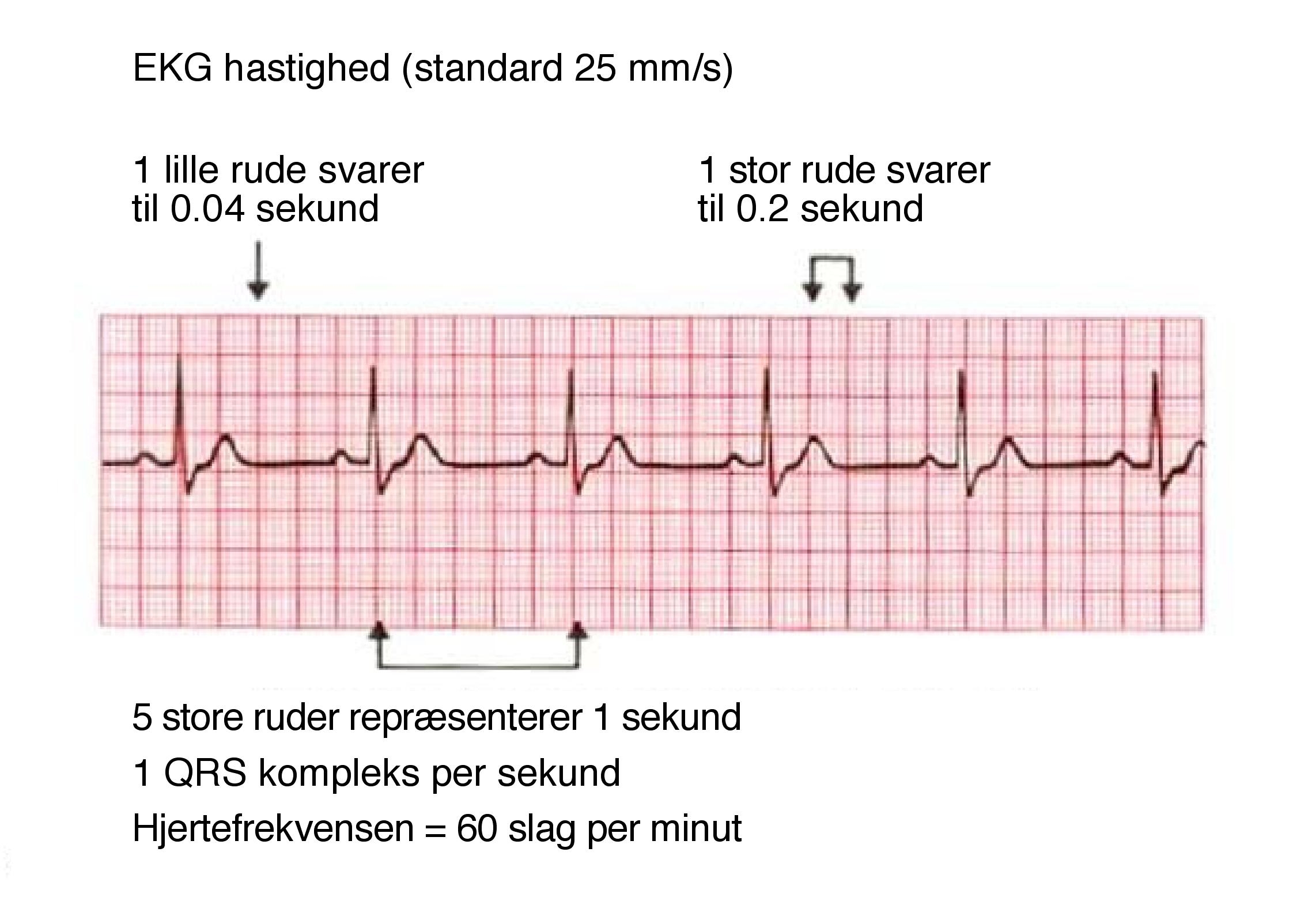 ekg hastighed