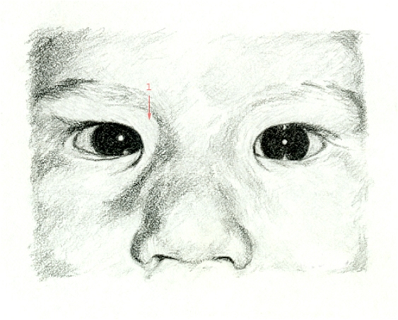 oejne-epicantusfold ved blik lige fremad