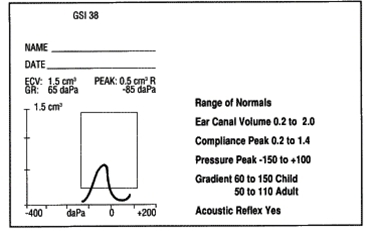 tympanometri-normalvaerdier