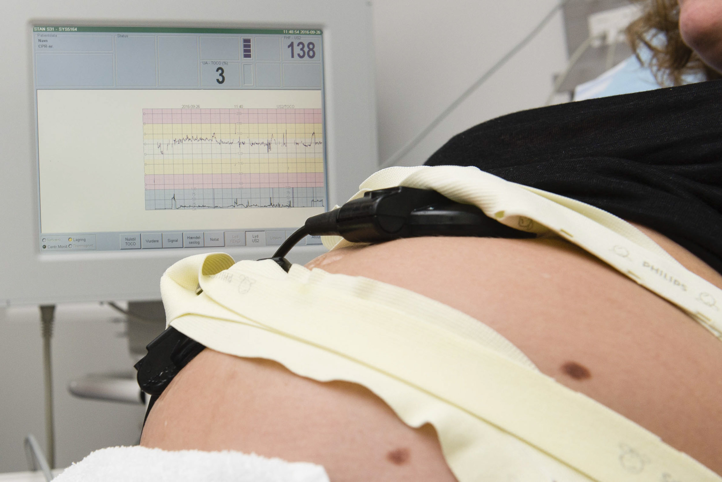 CTG optagelse