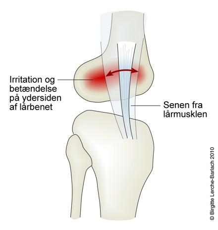 Tegning af løberknæ