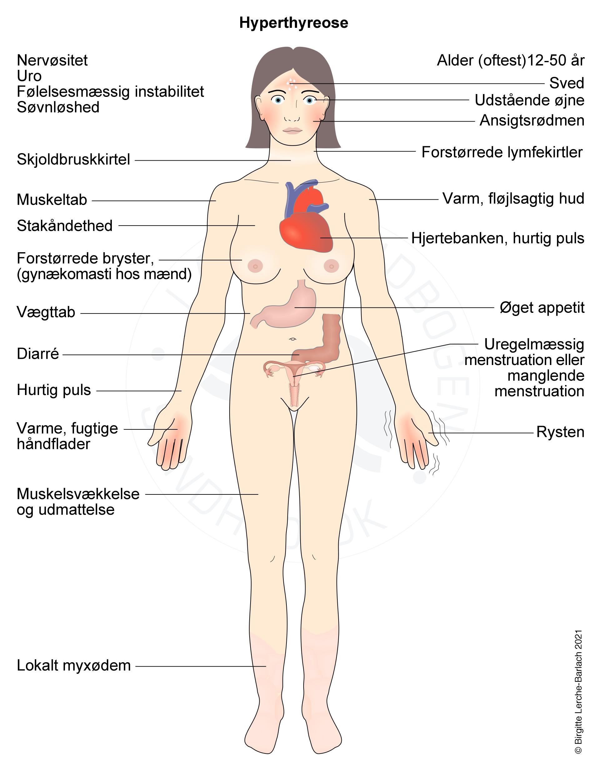 Symptomer ved hyperthyreose