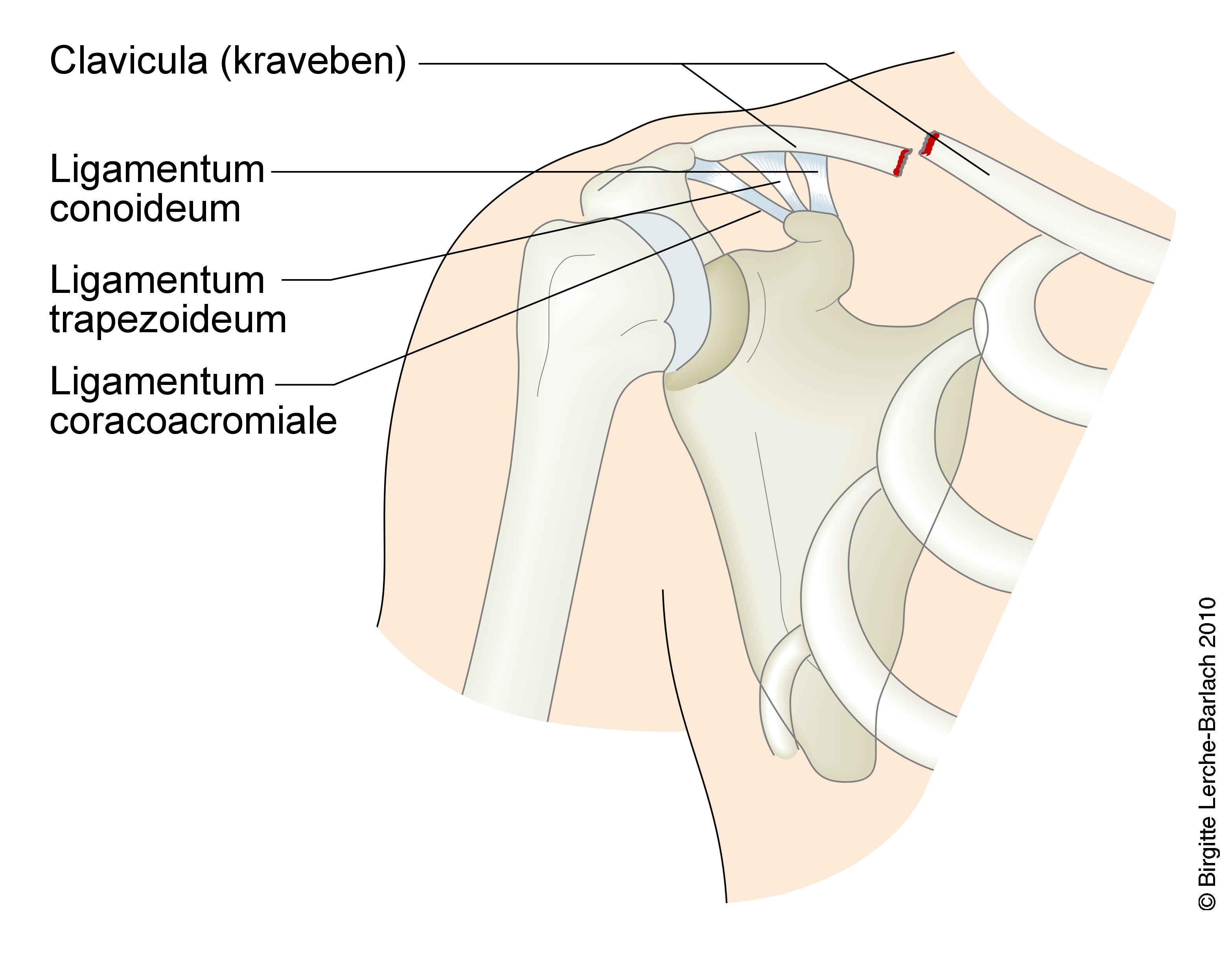 skulder-fraktur af claviculae