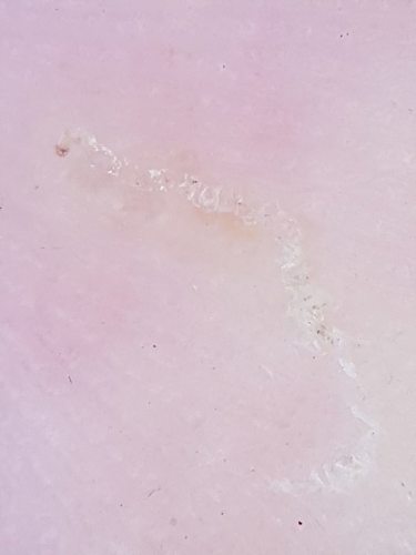 Fnat med midegang og lysebrun fnatmide for enden