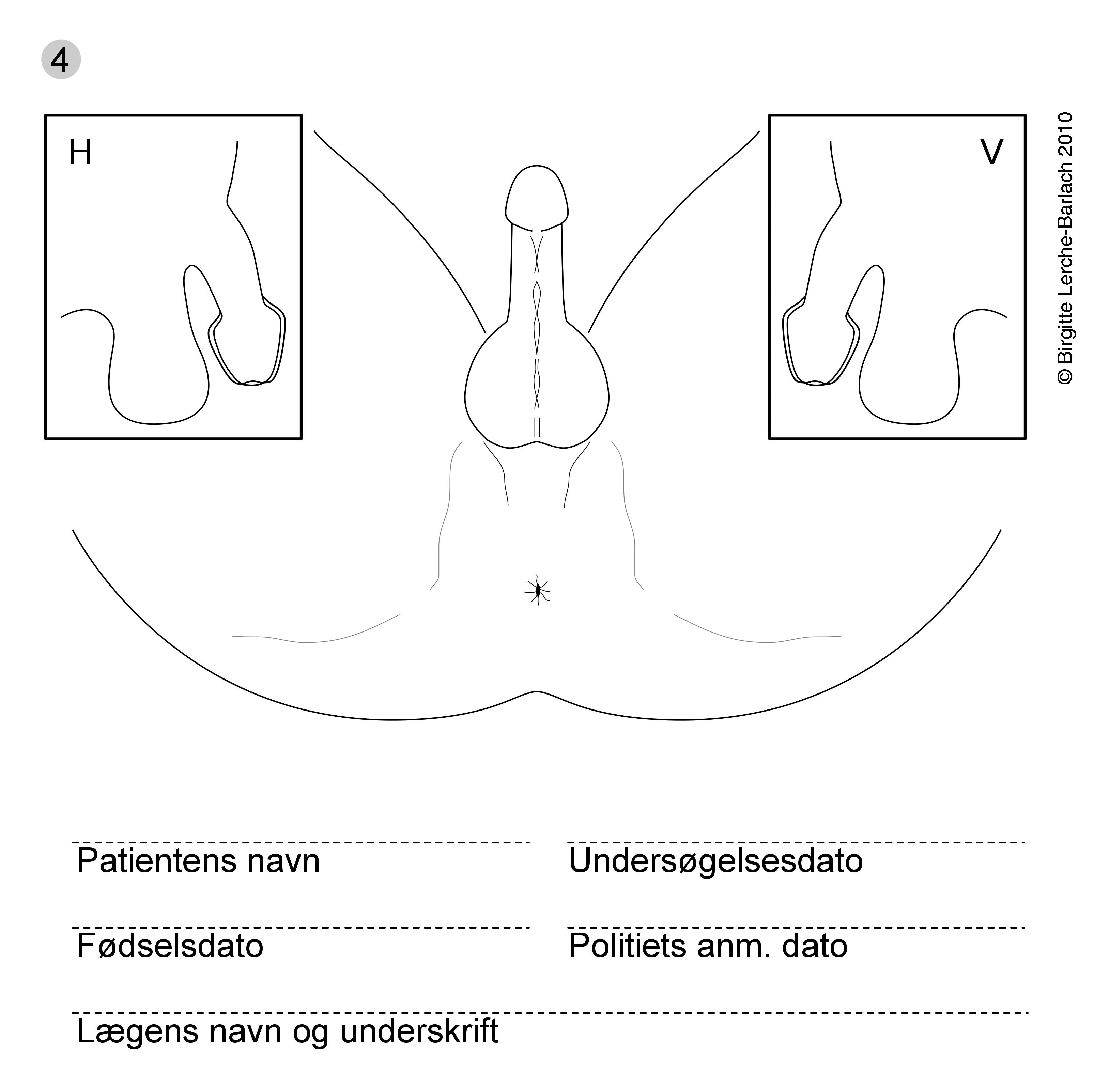 mandlige genitalia-voldtaegt skitse