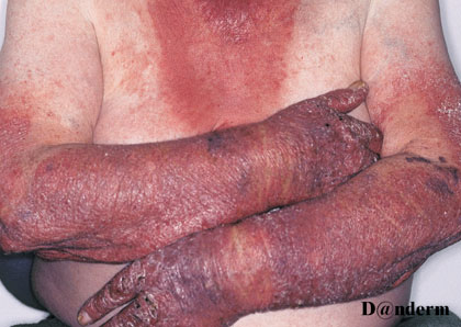 lgemiddeludslt 50501