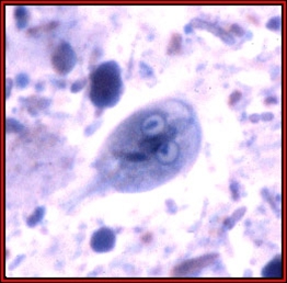 giardia lamblia-mikroskopi-infektioner