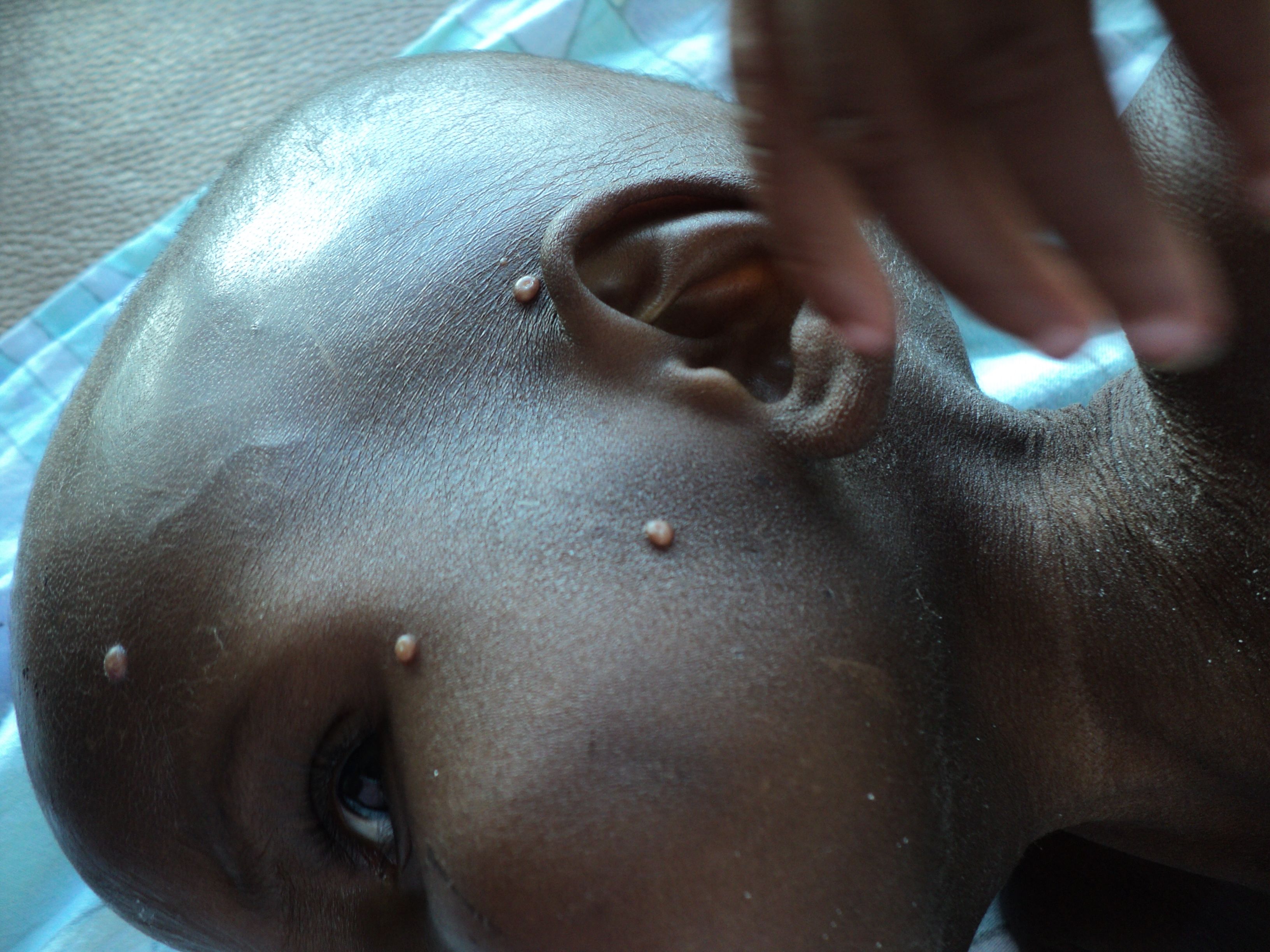 Vandvorter Uganda 50426