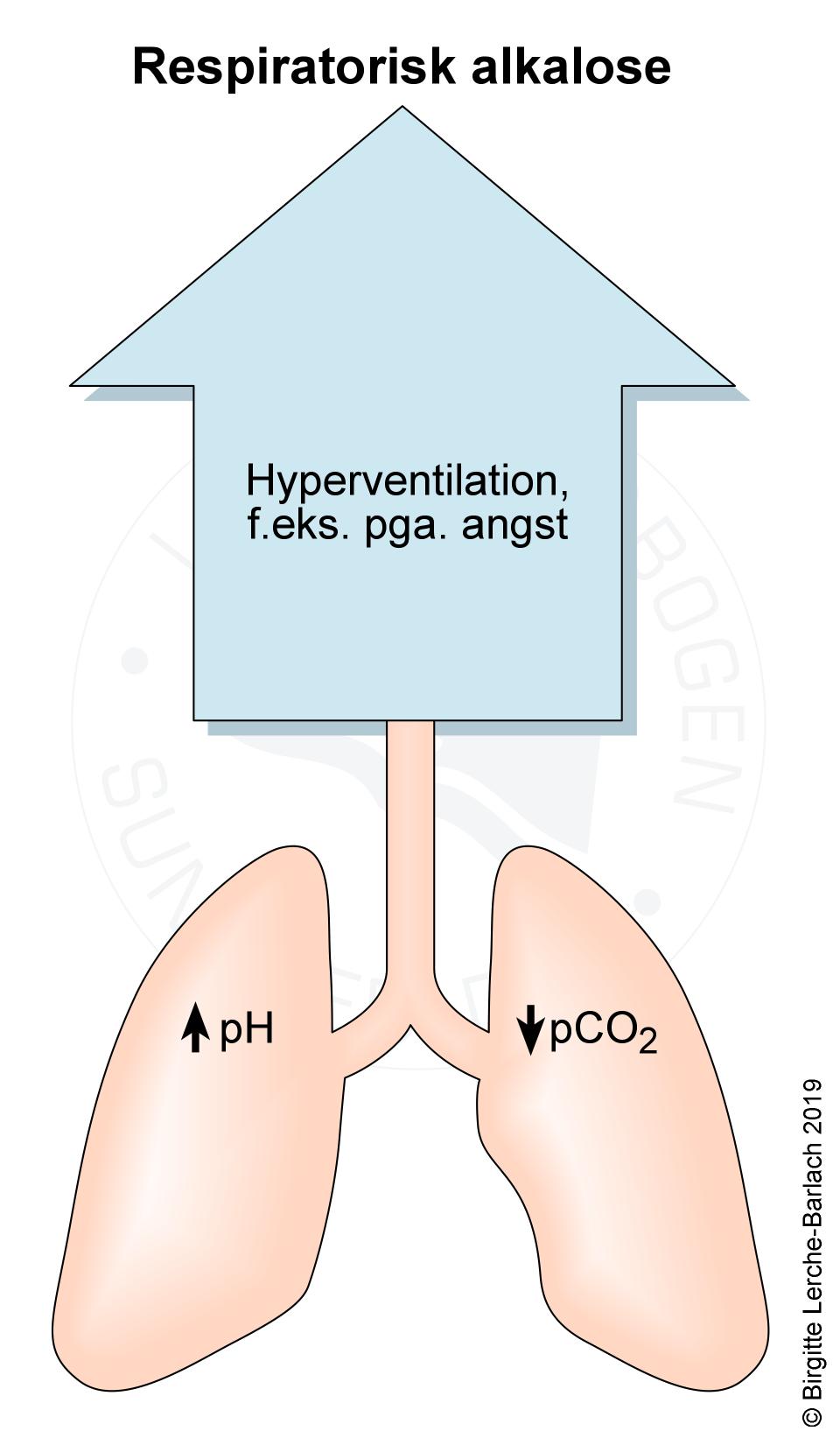 lunger-respiratorisk alkalose