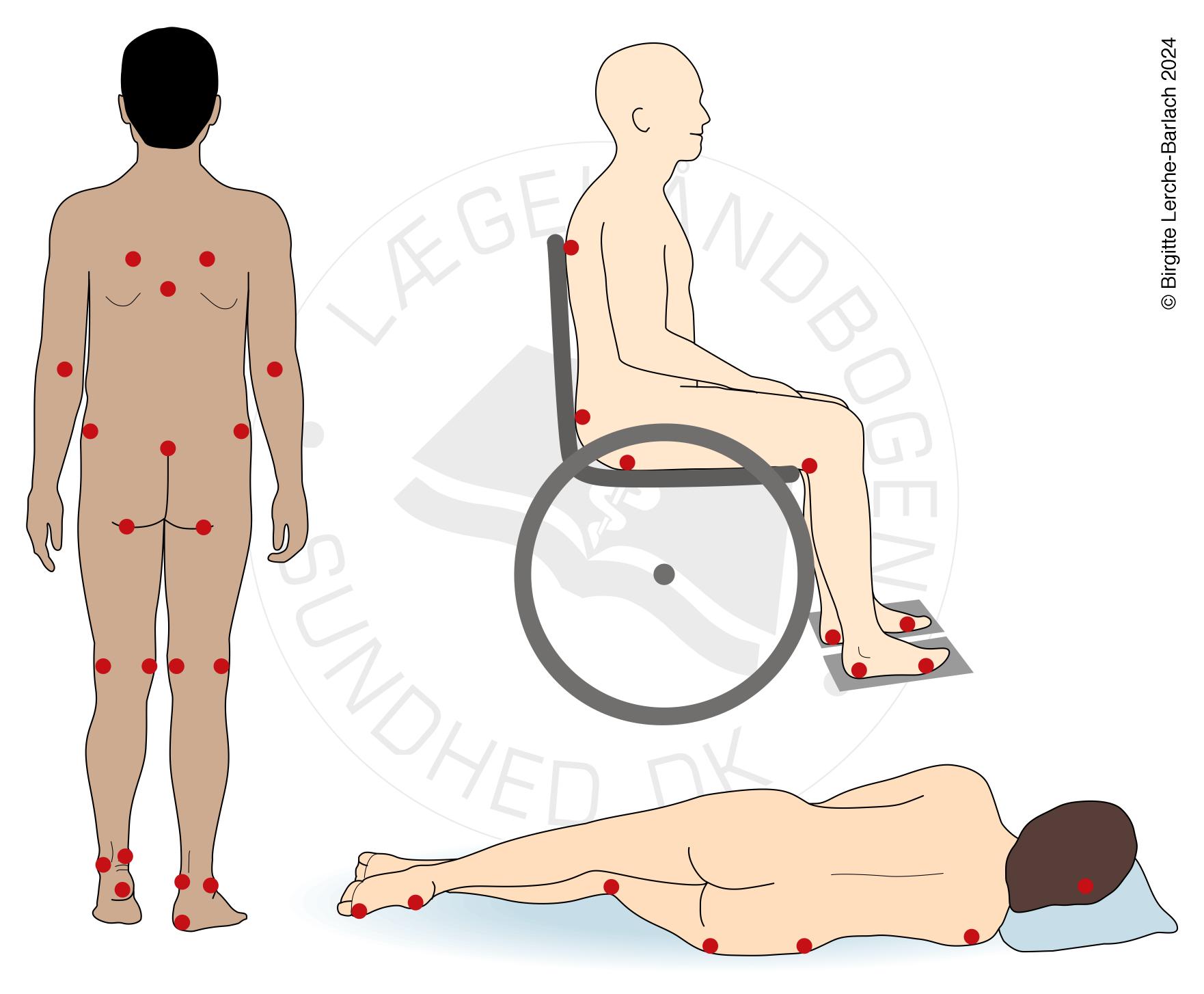 LH_Trykudsatte punkter