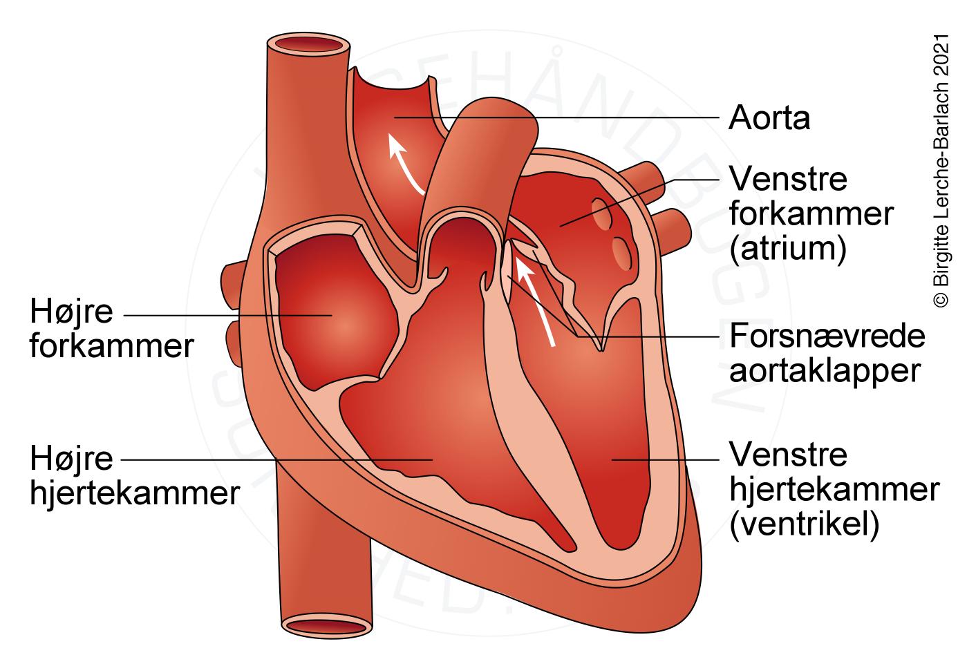 aorta-stenose