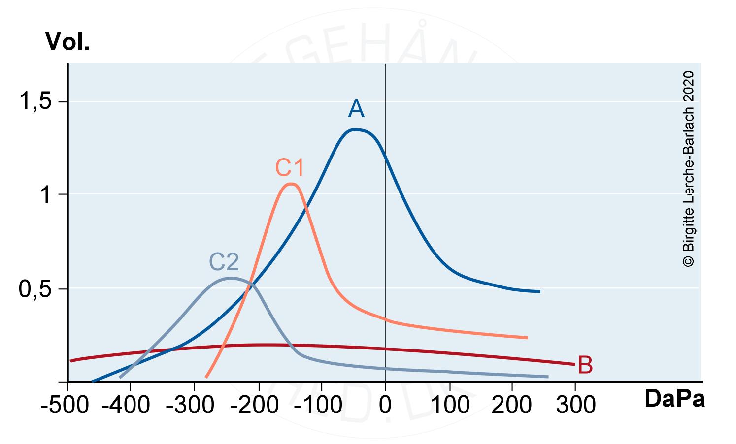 tympanometri-bevaegelighedsmoenstre