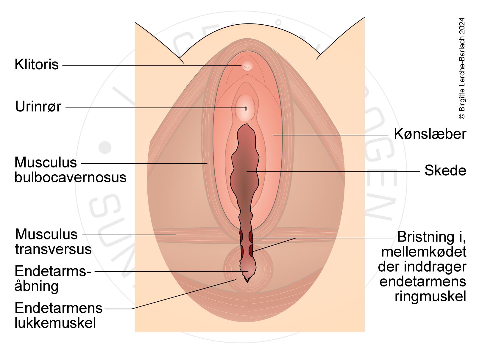 Skade paa lukke- og ringmuskel